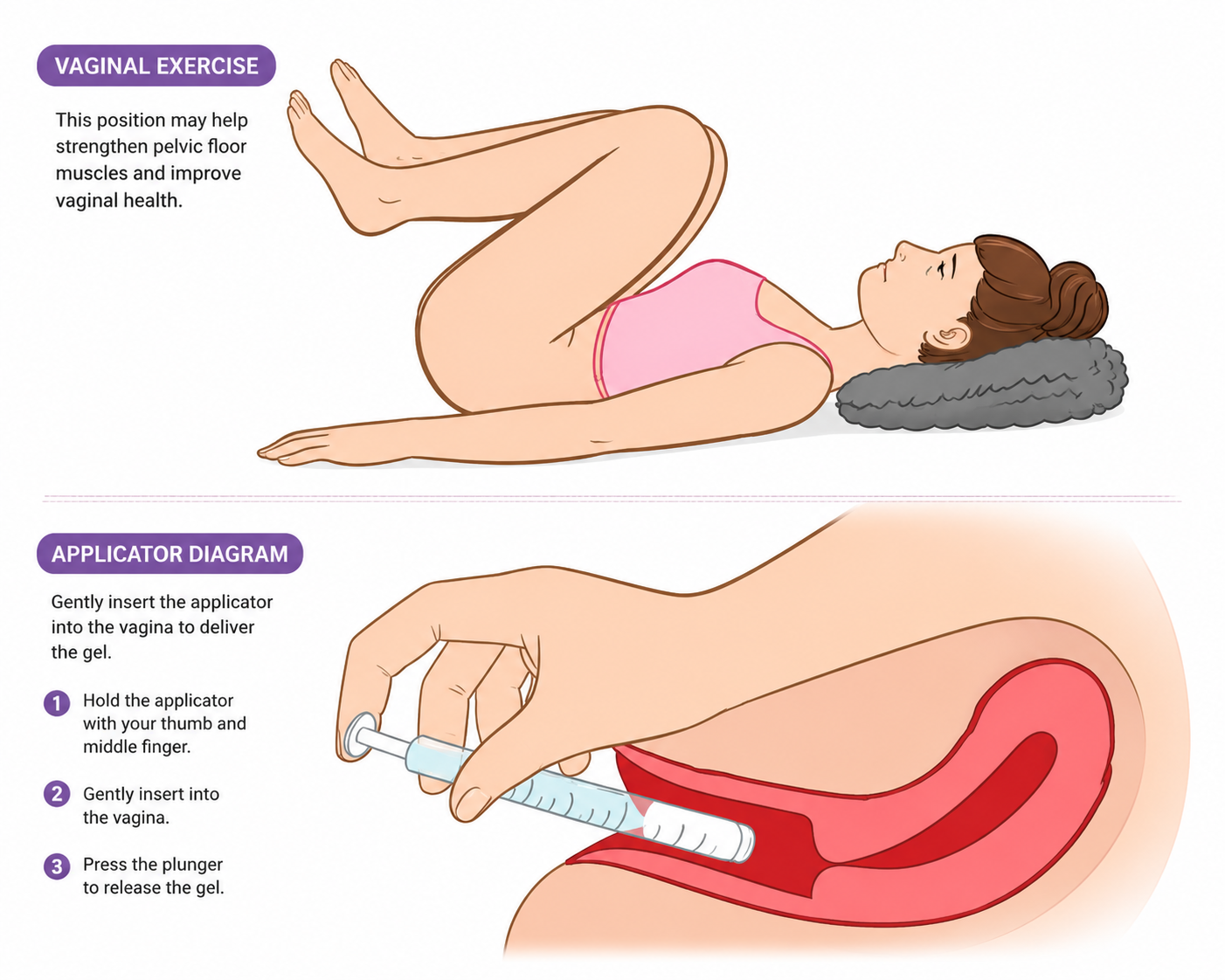 GYNESSA application guide and vaginal exercise diagram